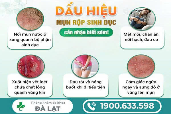 Hình ảnh minh họa